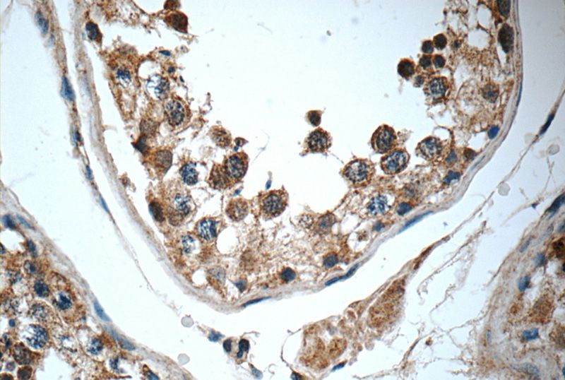 Immunohistochemistry of paraffin-embedded human testis tissue slide using Catalog No:116818(WDR92 Antibody) at dilution of 1:50 (under 40x lens)
