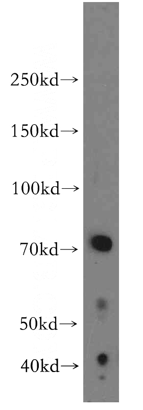 Raji cells were subjected to SDS PAGE followed by western blot with Catalog No:112319(LRMP antibody) at dilution of 1:500