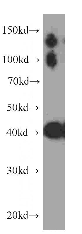 human skeletal muscle tissue were subjected to SDS PAGE followed by western blot with Catalog No:107175(CKM-Specific antibody) at dilution of 1:500