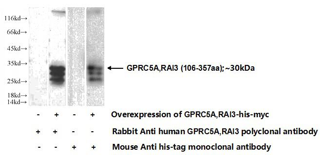 Transfected HEK-293 cells were subjected to SDS PAGE followed by western blot with Catalog No:111139(GPRC5A,RAI3 Antibody) at dilution of 1:700