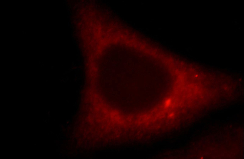 Immunofluorescent analysis of HepG2 cells, using TNIP2 antibody Catalog No:116145 at 1:25 dilution and Rhodamine-labeled goat anti-rabbit IgG (red).