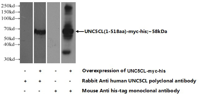 Transfected HEK-293 cells were subjected to SDS PAGE followed by western blot with Catalog No:116617(UNC5CL Antibody) at dilution of 1:1000
