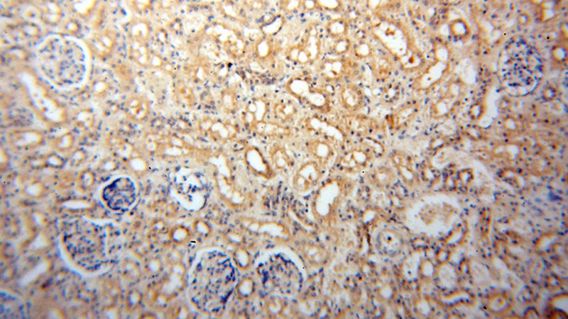 Immunohistochemical of paraffin-embedded human kidney using Catalog No:110123(DUSP9 antibody) at dilution of 1:100 (under 10x lens)