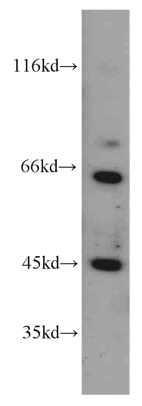 HeLa cells were subjected to SDS PAGE followed by western blot with Catalog No:116425(TSC22D4 antibody) at dilution of 1:200