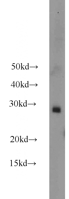NIH/3T3 cells were subjected to SDS PAGE followed by western blot with Catalog No:114436(RAB38 antibody) at dilution of 1:500