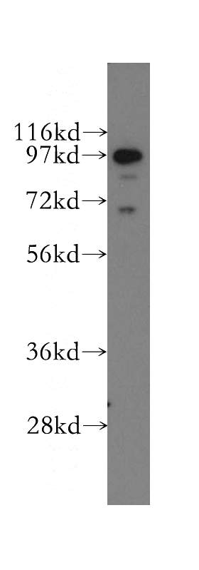human brain tissue were subjected to SDS PAGE followed by western blot with Catalog No:110394(EPS8 antibody) at dilution of 1:500