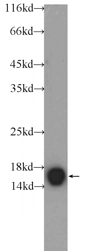 mouse brain tissue were subjected to SDS PAGE followed by western blot with Catalog No:108824(CALM3 antibody) at dilution of 1:500