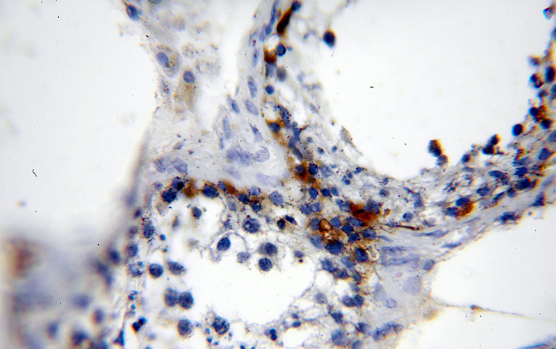 Immunohistochemical of paraffin-embedded human testis using Catalog No:112376(MAGEA1 antibody) at dilution of 1:100 (under 40x lens)