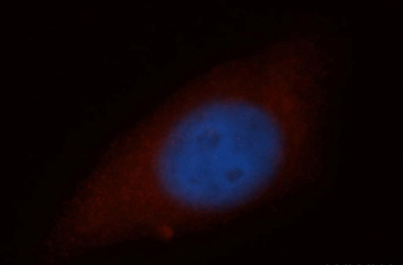Immunofluorescent analysis of HepG2 cells, using NCAPH antibody Catalog No:113032 at 1:50 dilution and Rhodamine-labeled goat anti-rabbit IgG (red). Blue pseudocolor = DAPI (fluorescent DNA dye).