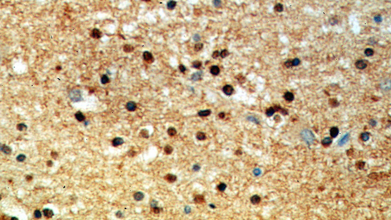 Immunohistochemical of paraffin-embedded human brain using Catalog No:116843(WASL antibody) at dilution of 1:50 (under 40x lens)