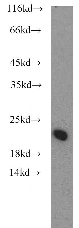 mouse liver tissue were subjected to SDS PAGE followed by western blot with Catalog No:113077(NDUFB8 antibody) at dilution of 1:500