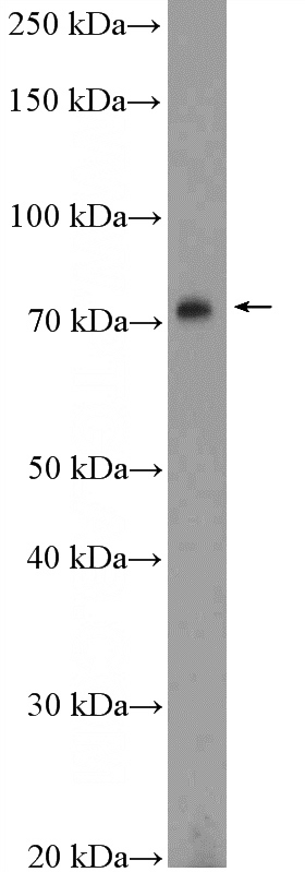 DU 145 cells were subjected to SDS PAGE followed by western blot with Catalog No:110872(GAS6 Antibody) at dilution of 1:600