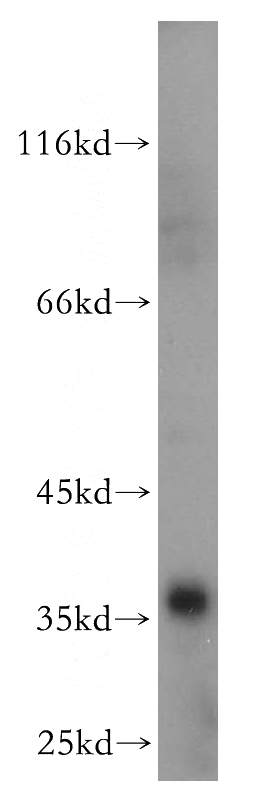 K-562 cells were subjected to SDS PAGE followed by western blot with Catalog No:109071(CCNY antibody) at dilution of 1:600