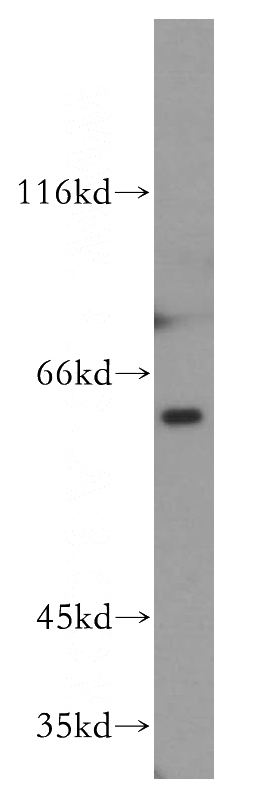 K-562 cells were subjected to SDS PAGE followed by western blot with Catalog No:113497(PAK1 antibody) at dilution of 1:400