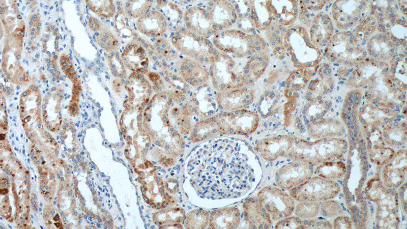 Immunohistochemistry of paraffin-embedded human kidney tissue slide using Catalog No:107834(AGPAT9 Antibody) at dilution of 1:200 (under 10x lens).