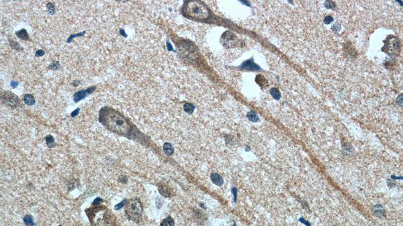 Immunohistochemistry of paraffin-embedded human brain tissue slide using Catalog No:107414(MAOB Antibody) at dilution of 1:50(under 40x lens)