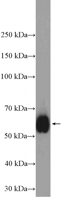 Jurkat cells were subjected to SDS PAGE followed by western blot with Catalog No:109064(CD2 Antibody) at dilution of 1:3000