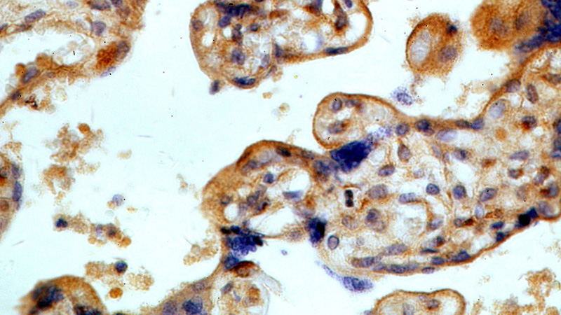 Immunohistochemical of paraffin-embedded human placenta using Catalog No:112991(MYOF antibody) at dilution of 1:100 (under 40x lens)