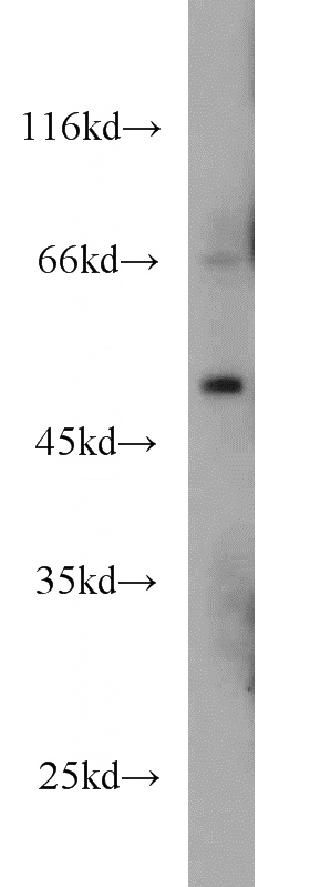 HeLa cells were subjected to SDS PAGE followed by western blot with Catalog No:112716(MKNK1 antibody) at dilution of 1:600