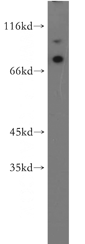 HEK-293 cells were subjected to SDS PAGE followed by western blot with Catalog No:112389(MAGED1 antibody) at dilution of 1:500