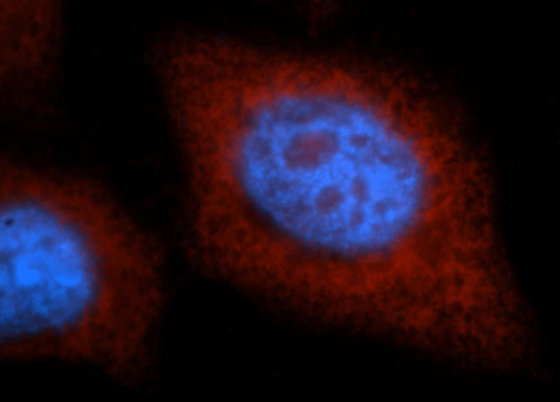 Immunofluorescent analysis of HepG2 cells, using KRAS antibody Catalog No: at 1:25 dilution and Rhodamine-labeled goat anti-rabbit IgG (red). Blue pseudocolor = DAPI (fluorescent DNA dye).
