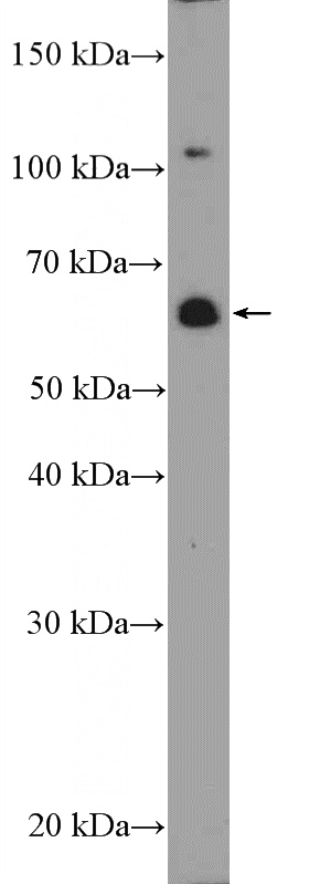 PC-3 cells were subjected to SDS PAGE followed by western blot with Catalog No:117173(ZNF397 Antibody) at dilution of 1:300