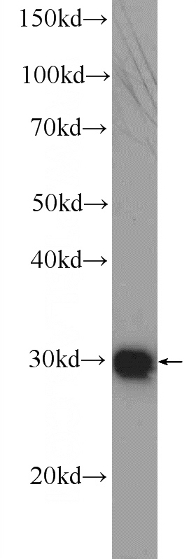 HeLa cells were subjected to SDS PAGE followed by western blot with Catalog No:109953(DNAJC9 Antibody) at dilution of 1:1000
