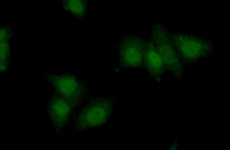 Immunofluorescent analysis of (10% Formaldehyde) fixed MCF-7 cells using Catalog No:116874(XRCC3 Antibody) at dilution of 1:50 and Alexa Fluor 488-congugated AffiniPure Goat Anti-Rabbit IgG(H+L)