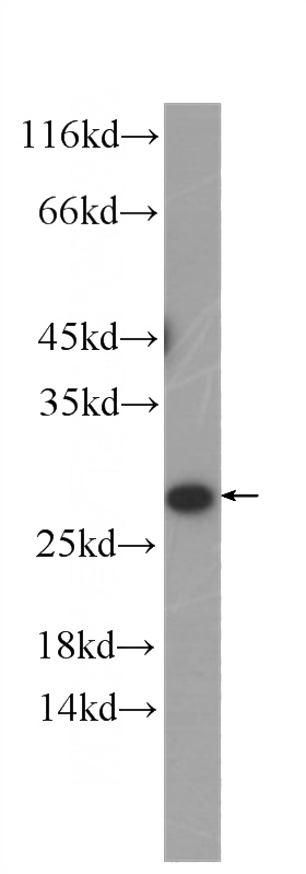 PC-3 cells were subjected to SDS PAGE followed by western blot with Catalog No:107523(SECTM1 Antibody) at dilution of 1:1000