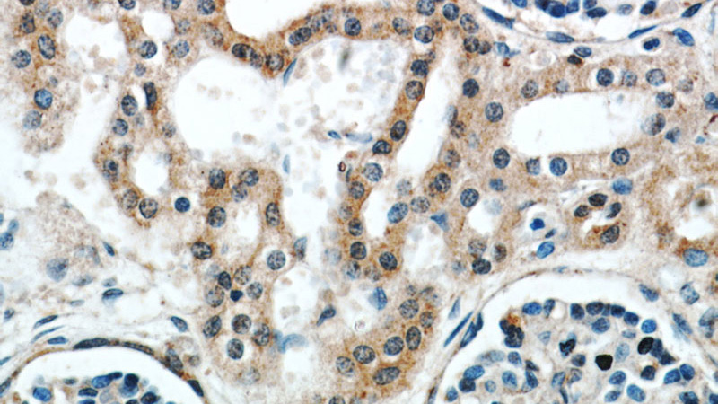 Immunohistochemical of paraffin-embedded human kidney using Catalog No:108977(CCDC50 antibody) at dilution of 1:50 (under 40x lens)