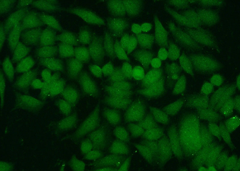 Immunofluorescent analysis of HeLa cells using Catalog No:111890(JNK Antibody) at dilution of 1:50 and Alexa Fluor 488-congugated AffiniPure Goat Anti-Rabbit IgG(H+L)