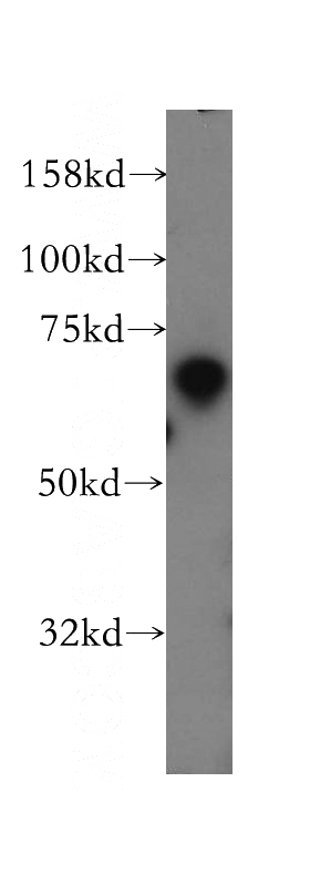 mouse testis tissue were subjected to SDS PAGE followed by western blot with Catalog No:116010(TFEC antibody) at dilution of 1:300