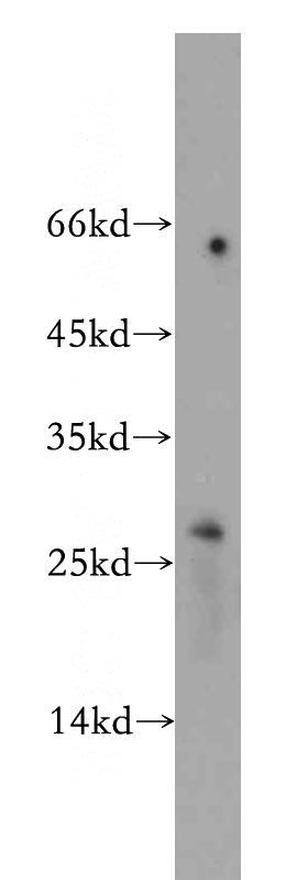 HeLa cells were subjected to SDS PAGE followed by western blot with Catalog No:108543(BTG4 antibody) at dilution of 1:500