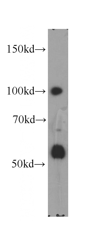 HEK-293 cells were subjected to SDS PAGE followed by western blot with Catalog No:116878(XRN2 antibody) at dilution of 1:200