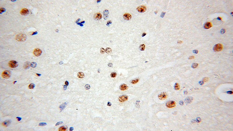Immunohistochemical of paraffin-embedded human brain using Catalog No:109935(DHX9 antibody) at dilution of 1:100 (under 40x lens)