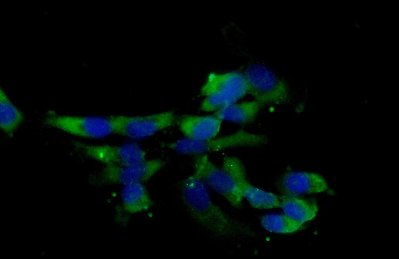 Immunofluorescent analysis of (-20oc Ethanol) fixed A431 cells using Catalog No:109133(CD63 Antibody) at dilution of 1:25 and Alexa Fluor 488-congugated AffiniPure Goat Anti-Rabbit IgG(H+L)