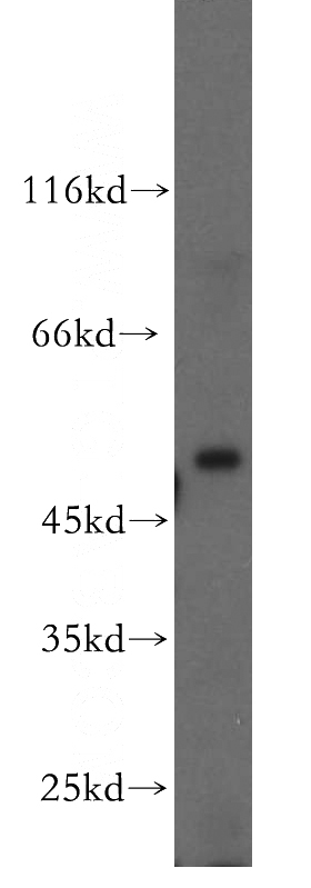 HeLa cells were subjected to SDS PAGE followed by western blot with Catalog No:109739(CUGBP1 antibody) at dilution of 1:200