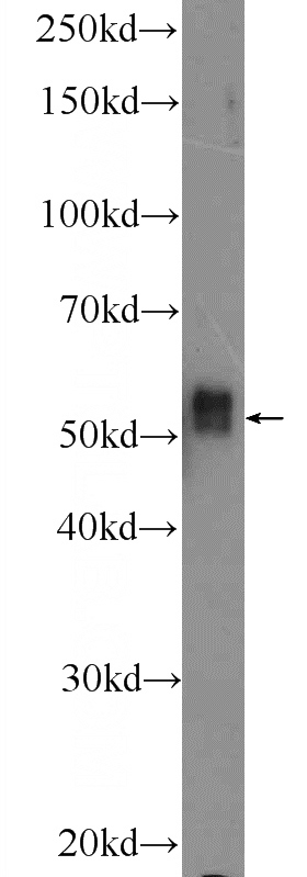 K-562 cells were subjected to SDS PAGE followed by western blot with Catalog No:111829(IRAK4 Antibody) at dilution of 1:300