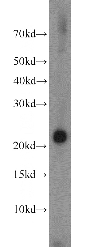 mouse kidney tissue were subjected to SDS PAGE followed by western blot with Catalog No:112287(PSMB8 antibody) at dilution of 1:1000