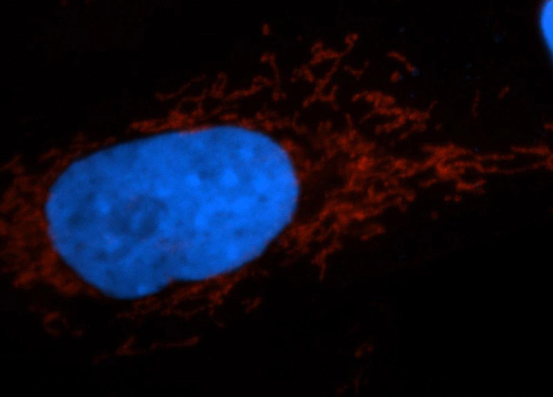 Immunofluorescent analysis of A549 cells, using TIMM44 antibody Catalog No:116133 at 1:50 dilution and Rhodamine-labeled goat anti-rabbit IgG (red). Blue pseudocolor = DAPI (fluorescent DNA dye).