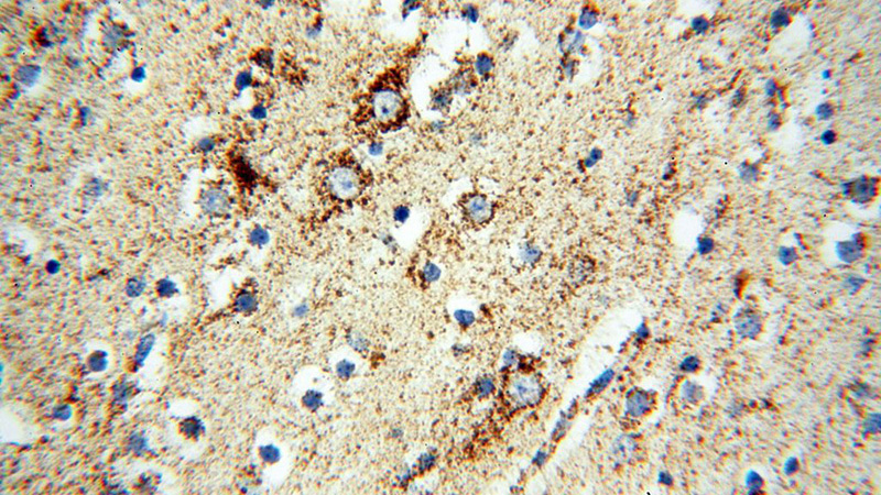 Immunohistochemical of paraffin-embedded human brain using Catalog No:113076(NDUFB7 antibody) at dilution of 1:100 (under 40x lens)