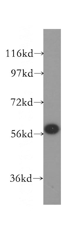 Raji cells were subjected to SDS PAGE followed by western blot with Catalog No:115135(SF3A3 antibody) at dilution of 1:300