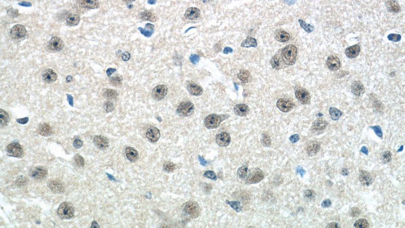 Immunohistochemistry of paraffin-embedded mouse brain tissue slide using Catalog No:108668(C15orf29 Antibody) at dilution of 1:50 (under 40x lens)