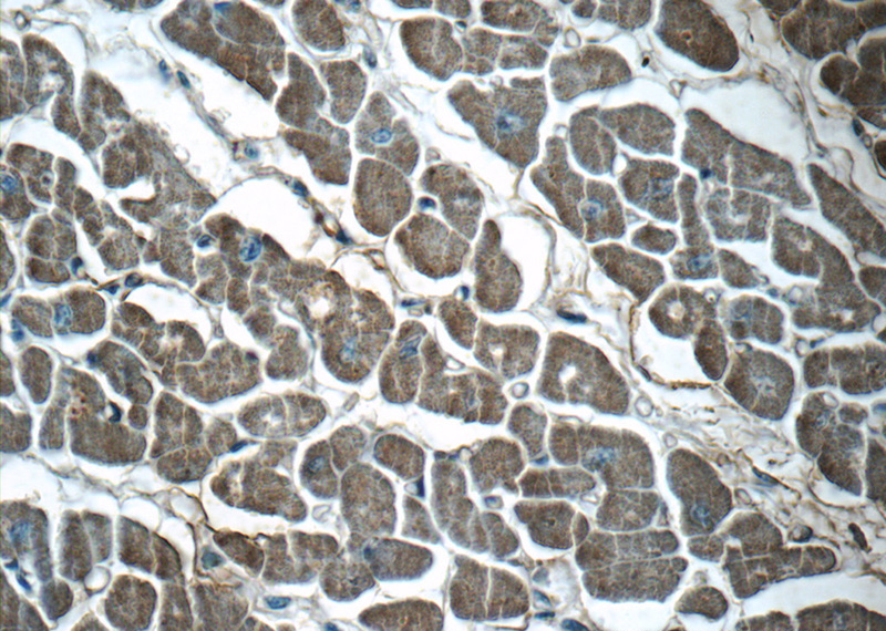 Immunohistochemistry of paraffin-embedded human heart tissue slide using Catalog No:116706(VAMP3 Antibody) at dilution of 1:50 (under 40x lens)