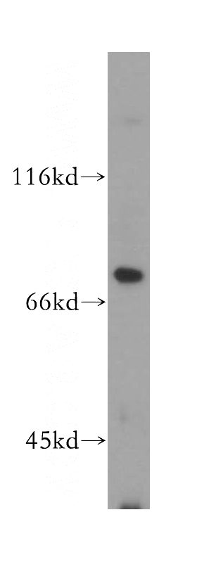 human placenta tissue were subjected to SDS PAGE followed by western blot with Catalog No:112464(MAN1A2 antibody) at dilution of 1:200