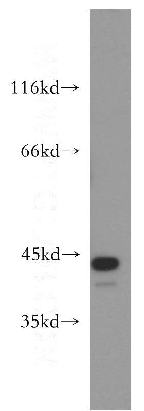 MCF7 cells were subjected to SDS PAGE followed by western blot with Catalog No:111900(JUNB antibody) at dilution of 1:500