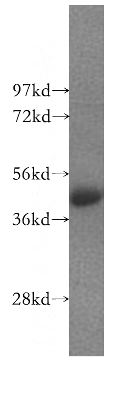 HEK-293 cells were subjected to SDS PAGE followed by western blot with Catalog No:111344(TGFB1I1 antibody) at dilution of 1:1000