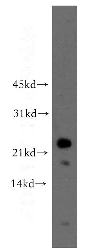 COLO 320 cells were subjected to SDS PAGE followed by western blot with Catalog No:114661(RHOF antibody) at dilution of 1:500