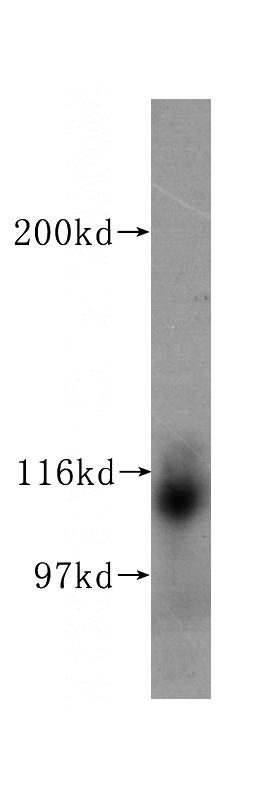 human blood tissue were subjected to SDS PAGE followed by western blot with Catalog No:107330(NRP1 antibody) at dilution of 1:500