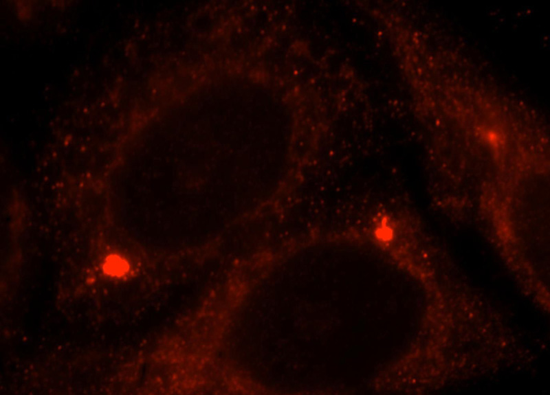 Immunofluorescent analysis of Hela cells, using ACAT1 antibody Catalog No:107727 at 1:25 dilution and Rhodamine-labeled goat anti-rabbit IgG (red).